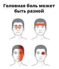 Golovnaya Bol Prichiny Vidy I Lechenie Chto Delat Pri Chastyh Golovnyh Bolyah
