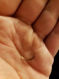 Deep ingrown hairs are hairs that have grown through the wall of the hair follicle, also sometimes referred to as embedded hairs. Hair Clump Pulled From My Belly Button Imgur