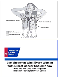 Pin On Lymphedema Info