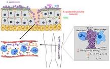 Image result for icd 10 code for sepsis due to staphylococcus epidermidis