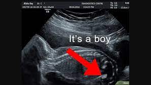 Gambar proses perkembangan pertumbuhan bayi janin dalam kandungan dan hasil usg 4d usia 14 minggu (3 bulan lebih) tulang dan sumsum tulang di dalam sistem kerangka terus berkembang. Cara Membaca Hasil Usg Lengkap Dengan Gambar Mamapapa Id
