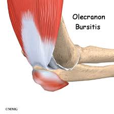 It forms the most pointed portion of the elbow and is opposite to the cubital fossa or elbow pit. Patient Education Concord Orthopaedics