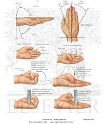 Measurement Of Wrist Motion And Finger Motion Lack Of
