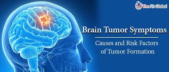Brain Tumor Symptoms Causes And Risk Factors Of Tumor Formation In 2020 Brain Tumor Symptoms Brain Tumor Tumor
