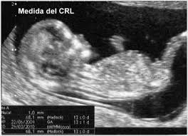 Gineco Pruebas Medicas