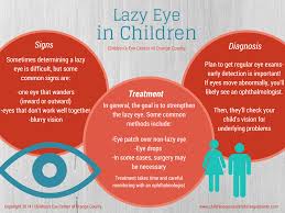 Lazy Eye In Children Dr Golareh Fazilat Md Children Eyes Eye Exam