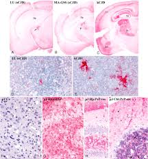 Döviz kuru takibini iki farklı şekilde yapabilirsiniz. The Kuru Infectious Agent Is A Unique Geographic Isolate Distinct From Creutzfeldt Jakob Disease And Scrapie Agents Pnas