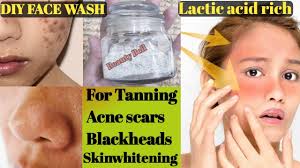 This is where these 6 homemade face washes for acne can make a clear difference. Diy Lactic Acid Rich Daily Face Wash For Tanning Acne Scars Blackheads Skinwhitening Youtube