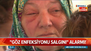Goz Enfeksiyonu Salginina Dikkat Atv Haber 3 Temmuz 2018 Youtube