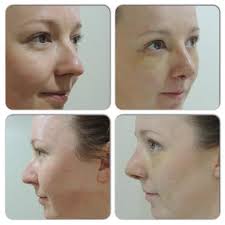 A Life-Changing Experience: From Surfboard to Boobylicious! -...