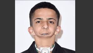 Joven sin mandíbula que escribe rap es nominado en premios para inspirad