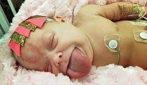 We did not find results for: ì„±ì¸ ë§Œí¼ í° í˜€ ê°–ê³  íƒœì–´ë‚œ ì•„ê¸° ë' ì°¨ë¡€ ìˆ˜ìˆ  ëì— í™œì§ ë‰´ìŠ¤ ë™ì•„ë‹·ì»´