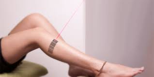 Tattoo removal is something we hope you'll never have to consider. Laser Tattoo Removal Pureskin Lab