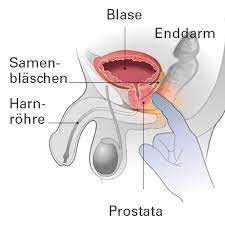Männer ab 45 jahren, jährlich. Frueherkennung Von Prostatakrebs Meine Prostata De