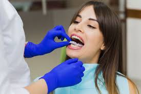 Gigapromo is the website to compare retainers to fix teeth. An All Inclusive Guide To Retainers After Braces