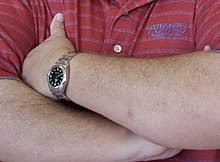 Squamous cell carcinoma (scc) of the skin is the second most common form of skin cancer, characterized by abnormal, accelerated growth of squamous cells.when caught early, most sccs are curable. Merkel Cell Carcinoma Wikipedia