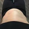 The muscles run along the left and right sides of the abdomen, from the ribcage to the pelvis. 1