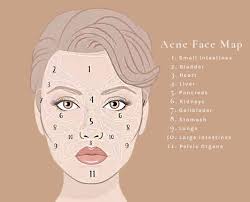 Face Mapping What Do Your Breakouts Actually Mean In 2020 Face Mapping Face Detox Face Breaking Out