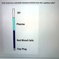 Hematocrit Determination.Pdf - Routine Hematology Laboratory Student Manual  Volume 1 Class No. Score Zingapan Jenine Maree M. Name: October 31 | Course  Hero