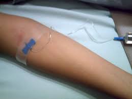 Iron injections are given intramuscularly, usually into the buttocks. Injection Medicine Wikidoc
