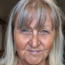 Can you touch toes after hip replacement?