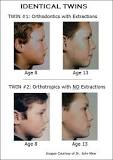 Image result for how much is orthotropic treatment