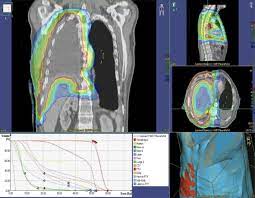 Mesothelioma is classed as an industrial disease. Management Of Malignant Pleural Mesothelioma Part 2 Therapeutic Approaches Springerlink