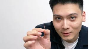 Heilen mit Nadeln: Vom Schmerz zur überraschenden Entspannung