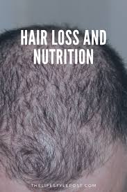 Can a hormonal imbalance cause hair loss? Hair Loss Hair Health And Nutrition The Lifestyle Post