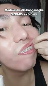 TOTOO NGA ANG CHIKA NG MGA MARITES. EPEKTIB NGA SA SINGAW TO. #singaw  #singawtreatment #singawsabibig #gamotsasingaw