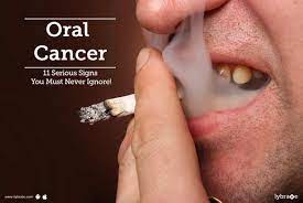 Oral hpv is transmitted to the mouth by oral sex, or possibly in other ways. Oral Cancer 11 Serious Signs You Must Never Ignore By Dr Nikunj K Vithalani Lybrate