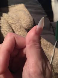 Maybe you would like to learn more about one of these? Celeste On Twitter I Just Googled Fake Nails On Clubbed Thumbs For Ideas And This Popped Up And Its So Relatable It S Not Even Funny