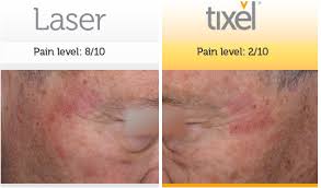 Последние твиты от tixel (@tixelofficial). Results Studies Spaland Eu