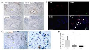 Hear clear pro è una copia di assistenti acustici piccolo e potente, che si inseriscono nelle orecchie e poi diventano invisibili. Cancers Free Full Text Unique Spatial Immune Profiling In Pancreatic Ductal Adenocarcinoma With Enrichment Of Exhausted And Senescent T Cells And Diffused Cd47 Sirpa Expression Html