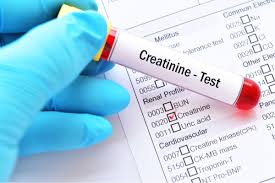 Continuous exercise can lead to high creatinine levels, and eventually kidney. Creatinine Definition And Overview Diabetes Self Management