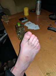 Saw a video of some weird feet on here and it reminded me of some dude I  met at a party with 6 toes : r/Weird