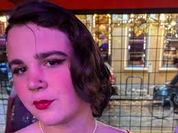 Fundraiser for Ivy Madrone by Ivy Madrone : Ivy Needs Your Help for  Life-Changing Surgery