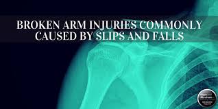 Image result for Fall on Shoulder