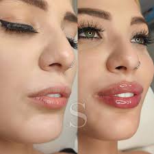 ASA Aesthetics by Sarah Ann