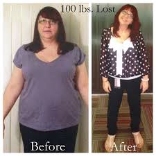 Health Medical Needs To Lose Weight Marconwya645 Over Blog Com