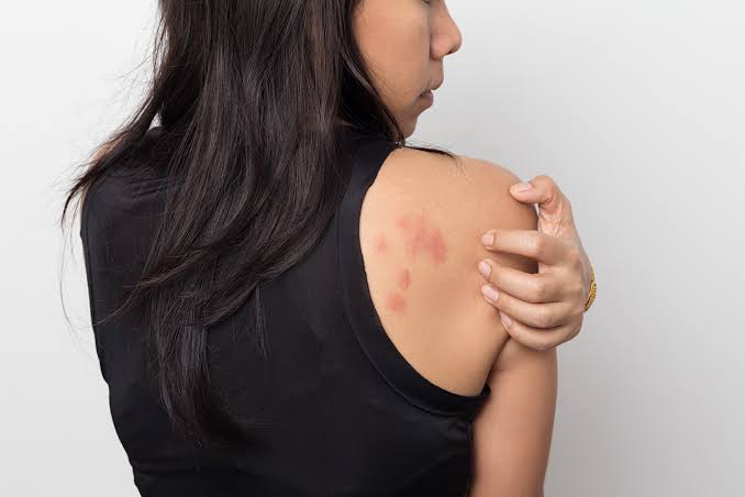 Skin Rashes: When to Seek Treatment - SJH Derm