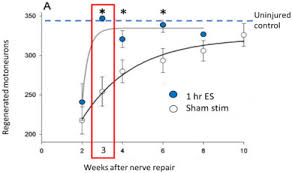 Since sensory nerves heal faster, full regeneration and recovery is expected to be within a year. Electrical Stimulation To Enhance Peripheral Nerve Regeneration Update In Molecular Investigations And Clinical Translation Sciencedirect
