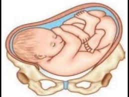 A transverse baby position, on the other hand, is when the baby lies across the stomach with her head facing away from the birth canal. Treatment For Transverse Lie Of Baby Youtube