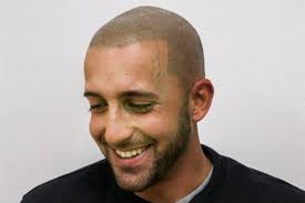 By applying natural pigments to the epidermal level of the scalp, experts will duplicate the natural look of real hair strands or follicles. A Guide To Hairline Tattoos Man Of Many