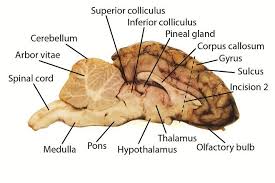 Use The Labeled Picture To Identify The Corpus Callosum Medulla Pons Midbrain And The Place Where Pituitar Nervous System Anatomy Brain Anatomy Dissection
