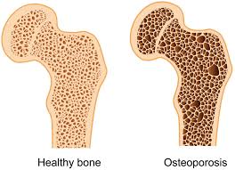 Maybe you would like to learn more about one of these? 8 Odd Reasons Maca Does A Body Good Yuri Elkaim