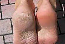 Lunettes Toujours Sales L Astuce Pour Qu Elles Restent Impeccables 3 Fois Plus Longtemps Astuces Grand Mere Pied Sec Creme Pour Les Pieds Et Vinaigre B