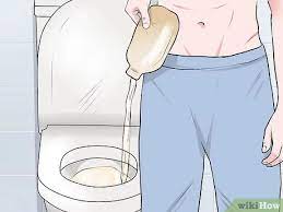 One woman who is living with a colostomy bag opens up about the realities of living with one, from love to work. How To Change A Colostomy Bag 12 Steps With Pictures Wikihow