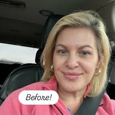 Blonde to red was successful!!!! I love changing things up for my clients,  especially when the change brings out the best in skin color!!! We did a  little bit of filler, then