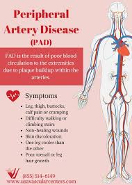 Pin On Pad Peripheral Artery Vascular Disease Treatment